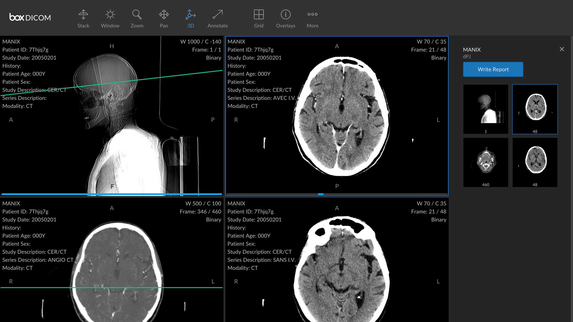 DICOM-Viewers-on-SelfGrowth.Us