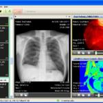 DICOM viewer for Linux