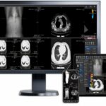 DICOM viewer HTML5