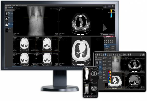 DICOM viewer HTML5