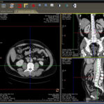 DICOM image viewer online