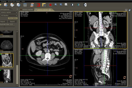 DICOM image viewer online