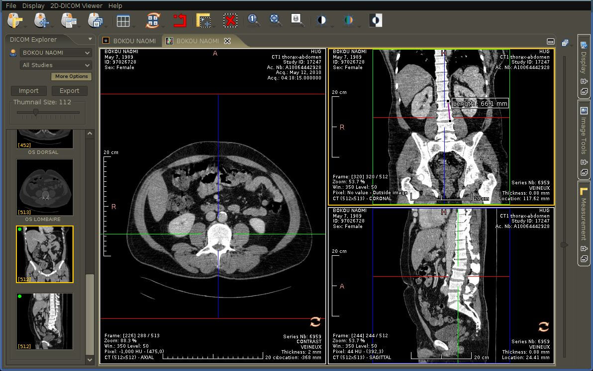 DICOM image viewer online